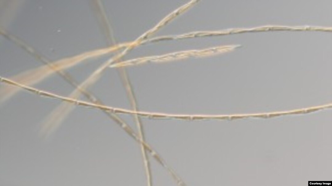 A magnified image of Pseudo-nitzschia australis. (C. Wingert/Cochlan San Francisco State University_