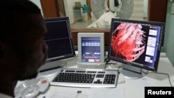 FILE - A doctor checks a screen showing a graphical representation of a human heart.