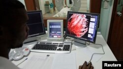 FILE - A doctor checks a screen showing a graphical representation of a human heart.