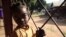 A girl waits at Bossangoa hospital, where medics are treating a high number of children for malaria, malnutrition, anaemia and violence-related injuries inlcuding gunshot wounds, Nov. 9, 2013. (Hanna McNeish for VOA.)