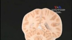 Ուղեղի կառուցվածքը և մարդկային վարքագիծը