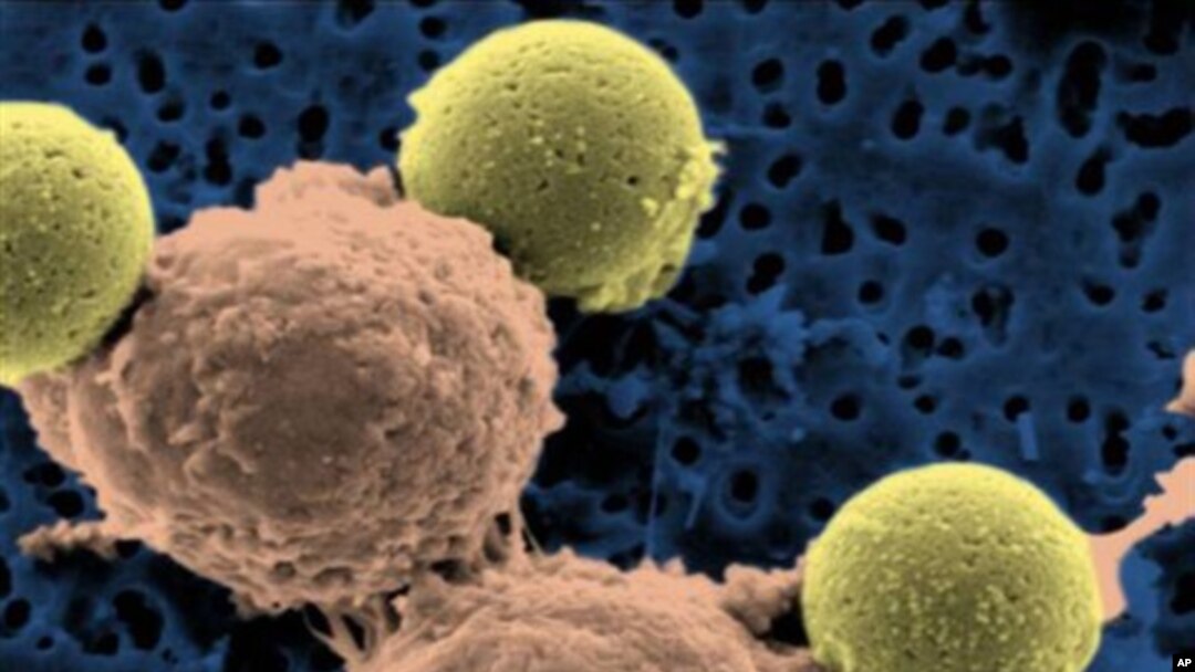 Gambar mikroskop dari sel-T (tengah) yang kemudian dimasukkan ke dalam tubuh pasien leukemia. (AP)