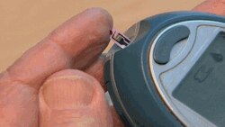 Një studim i ri zbulon gjenin shkaktar të Diabetit të Tipit 2