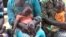 Fourteen-month-old Georgette Lukaji (L) rests in her mother's lap as she and other children wait to be treated at a roadside UNICEF clinic, in Kananga, Democratic Republic of Congo. (A. Powell/VOA)