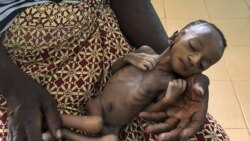 Daybreak Africa: MSF Warns of Acute Malnutrition in Northwest Nigeria