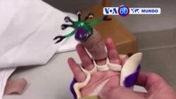 Manchetes Mundo 19 de Julho 2017: Criança com transplante duplo de mãos come e veste sozinha