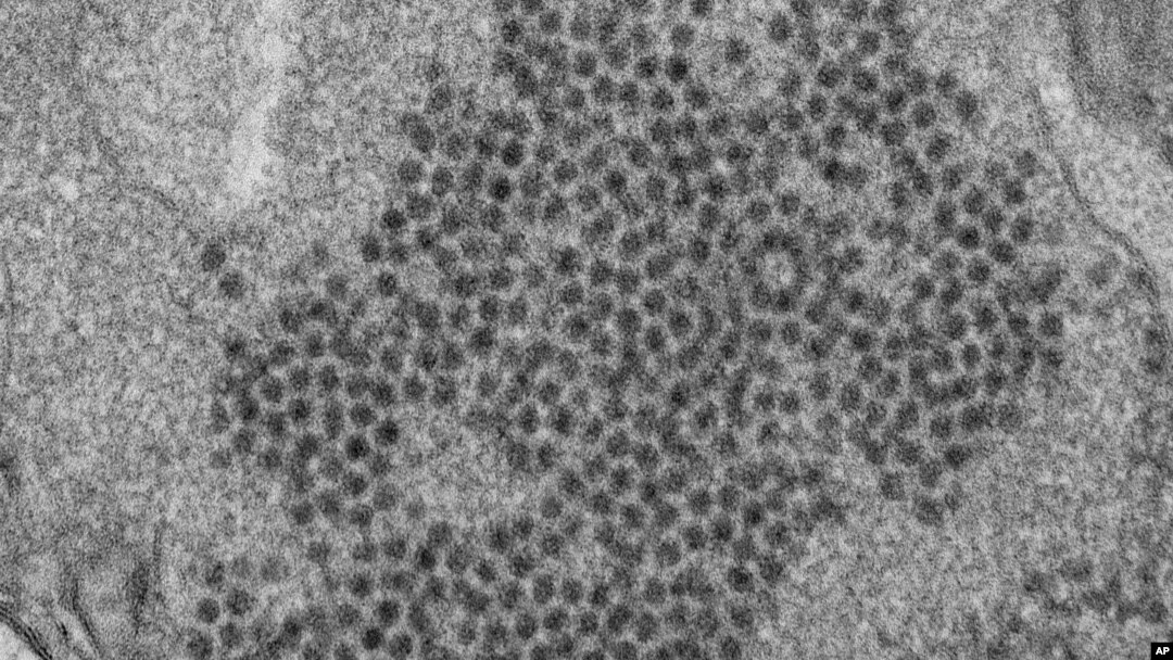 Dalam foto 2014 yang dirilis Pusat Pencegahan dan Pengendalian Penyakit AS (CDC) menunjukkan Enterovirus-D68. Para dokter menduga acute flaccid myelitis, penyakit yang menimbulkan kelumpuhan pada anak, mungkin terkait virus tersebut.