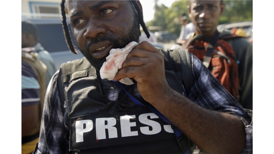 Photojournalist Dieu Nalio Chery holds a healing gauze next to his mouth in Port-au-Prince, Haiti, September 23, 2019.