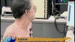 Biyonik Kol Hayatı Kolaylaştırıyor