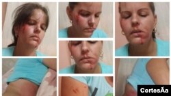 Photographs of Mabel Páez, a Cuban journalist who says she was attacked by masked men she believes were working for the government. (Mabel Páez via ICLP)