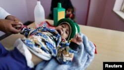 Seorang anak perempuan dirawat di pusat medis bagi mereka yang kekurangan gizi di Sanaa, Yaman, 4 November 2017. 