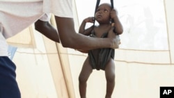 Un enfant mal nourri au Soudan du Sud (AP Photo/ Matthew Abbott)