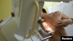 A woman undergoes a mammography exam, a special type of X-ray of the breasts used to detect tumors.