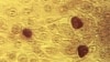 ARCHIVO – En esta imagen de microscopio de 1975, puesta a disposición por los Centros para el Control y la Prevención de Enfermedades, se muestra la bacteria Chlamydia trachomatis. (Dr. E. Arum, Dr. N. Jacobs/CDC vía AP). 