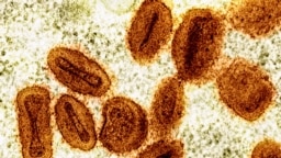 Virus mpox dưới kính hiển vi.