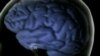 Researchers Development Potential Test to Predict Alzheimer's