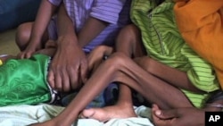 Malnourished children in Ethiopia