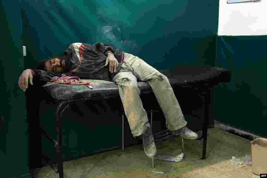 A Syrian man awaits treatment at a makeshift hospital in Zamalka, near Syria's capital Damascus.