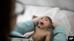 In this Feb. 12, 2016 photo, Lara, who is just under 3- months-old and was born with microcephaly. She is examined by doctors in Paraiba state, Brazil. Paraiba and Pernambuco in Brazilís impoverished northeast are ground zero for the Zika epidemic. (AP Photo/Felipe Dana)