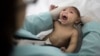 Baby Born in NJ to Zika-Infected Mom Has Microcephaly