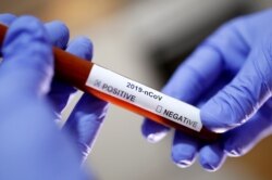 Test tube with Corona virus name label is seen in this illustration taken on January 29, 2020. REUTERS/Dado Ruvic/File Photo