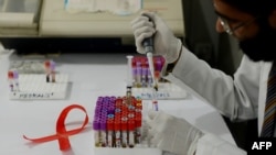 Seorang teknisi Pakistan mengambil sampel di laboratorium sementara tampak di dekatnya pita yang mempromosikan Hari AIDS Sedunia di Islamabad tanggal 30 November 2013 (foto: AFP Photo/Farooq Naeem)