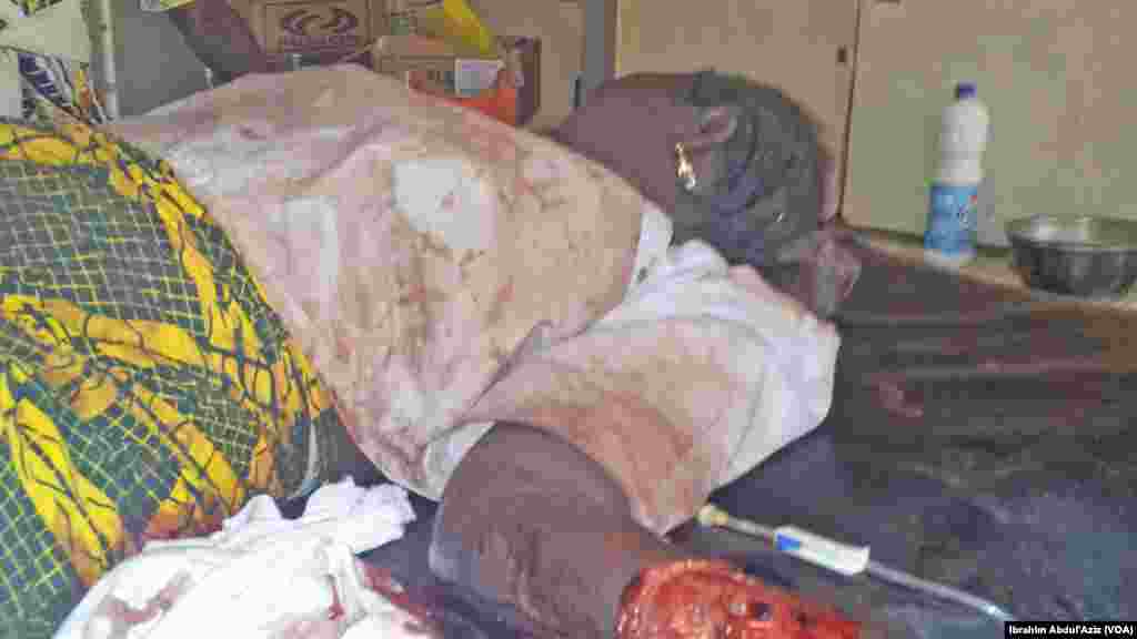 Wasu mutane da suka ji raunuka bayan harin 'yan bindiga da ake zaton Boko Haram ne a kauyen Chakawa ran 26 ga watan Junairu, 2014.