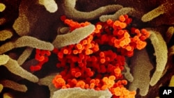 The National Institute of Allergy and Infectious Diseases provided this image of SARS-CoV-2 (orange), also known as 2019-nCoV, the virus that causes COVID-19, isolated from a patient in the U.S., emerging from the surface of cells cultured in the lab.