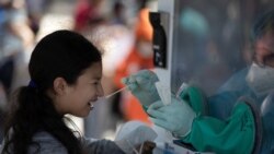 El Salvador: Sub-registro casos COVID-19