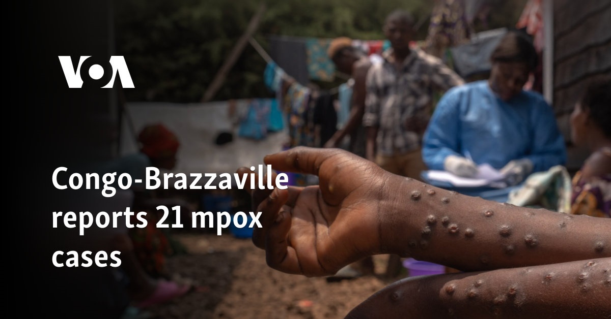  Congo-Brazzaville reports 21 mpox cases