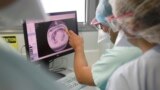 Medical workers check a X-ray photo of a lung of a patient suffering of COVID-19 in the Nouvel Hopital Civil of Strasbourg, eastern France, Thursday, Oct.22, 2020. (AP Photo/Jean-Francois Badias)