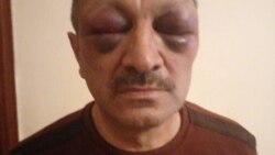 Tofiq Yaqublu aksiyadan sonra