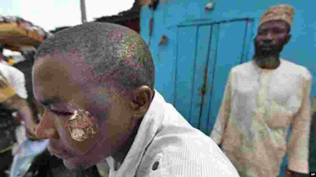 A young man shows his injuries after an immigration raid at Katangua Market in Lagos.