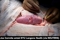 Ginjal babi hasil rekayasa genetika tampak sehat selama operasi transplantasi di NYU Langone di New York, AS (Foto: Joe Carrotta untuk NYU Langone Health via REUTERS)