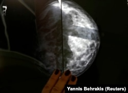 Seorang pasien kanker payudara Yunani menunjukkan hasil x-ray setelah pemeriksaan radiologis di sebuah rumah sakit. (Foto: REUTERS/Yannis Behrakis)