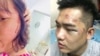 Ân xá Quốc tế kêu gọi điều tra vụ công an tra tấn người sau đêm nhạc Nguyễn Tín