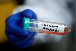 FILE PHOTO: Scientist Linqi Zhang shows a tube with a solution containing COVID-19 antibodies in his lab where he works on research into novel coronavirus disease (COVID-19) antibodies for possible use in a drug at Tsinghua University's Research