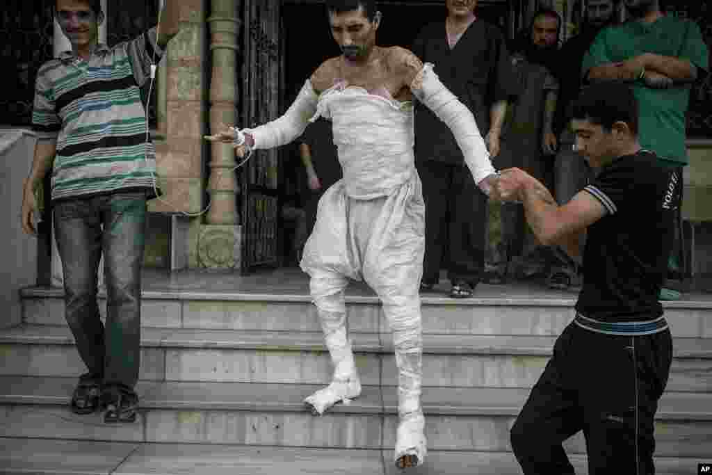 A Syrian man with more than half his body burnt from an air strike leaves a field hospital to go back home at a village turned into a battlefield with government forces in Idlib province, Sept. 22, 2013.