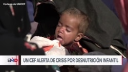 UNICEF: Casi dos millones de niños en riesgo de muerte por desnutrición severa