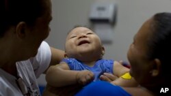 Criança nascida com microcefalia no Brasil