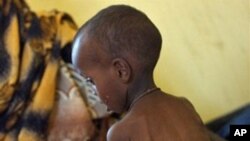Meio milhão de crianças em risco de morte no Corno de África