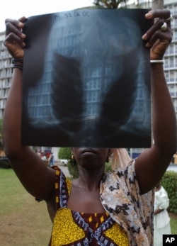 FILE - A woman who did not want to be identified, claiming that she has lung damage after a toxic waste discharge in Abidjan, holds up her lung x-ray at a hospital in Abidjan, Ivory Coast.