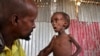 Study of Nutrition Crisis Finds Millions Either Malnourished or Obese