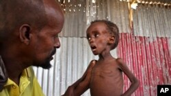 FILE - Ali Madey holds his malnourished child Mohamed Ali, 5, in their camp for the displaced on the outskirts of Mogadishu, Somalia, May 25, 2017. 