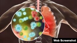 Koronavirus