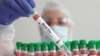 WHO: First fatal human case of H5N2 bird flu identified