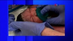 Primer bebé afectada por zika nace en NJ