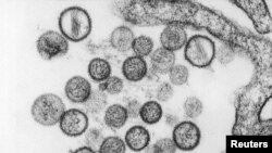 Los Centros para la Prevención y Control de Enfermedades de EE.UU. presentaron esta imagen microscópica del hantavirus.