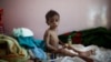 UN Agency: Child Malnutrition at 'All-time High' in Yemen