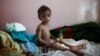 UN Humanitarian Chief: Yemen 'One Step Away from Famine'